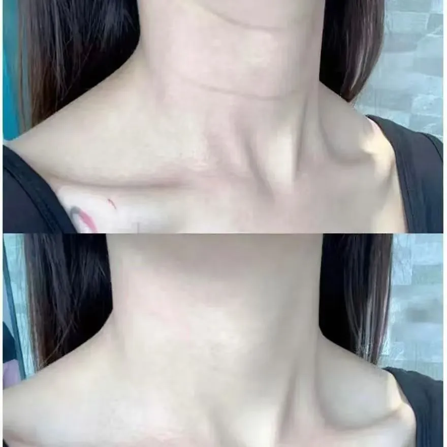 Easily Erase Body Wrinkles with AI Wrinkle Remover