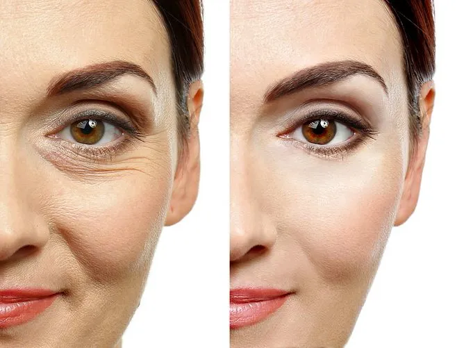 Free App to Remove Wrinkles on Any Device, Any Time
