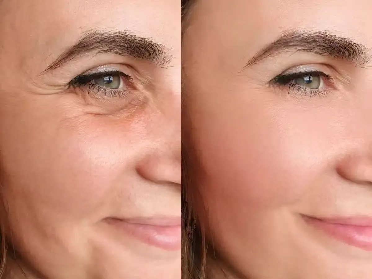 Free AI Wrinkle Remover