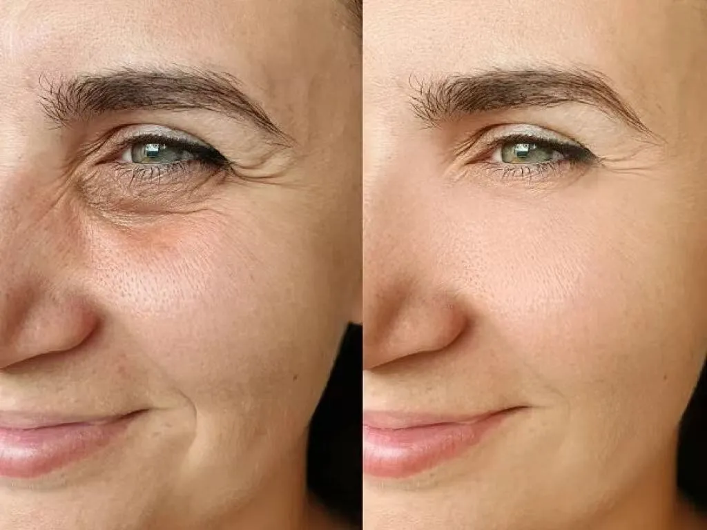 Smooth Face Wrinkles