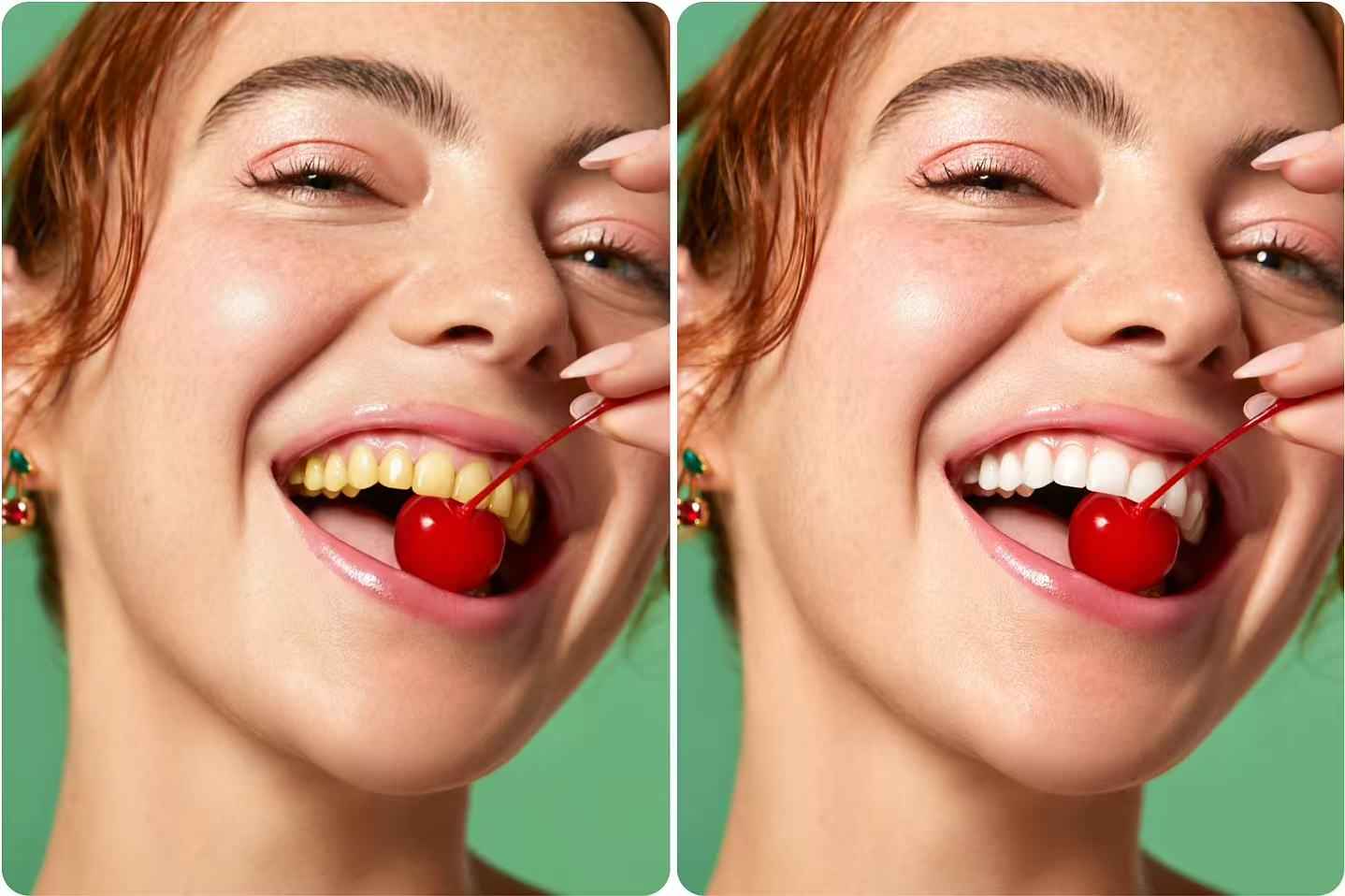 Free AI Teeth Whitening Photo Editor Online